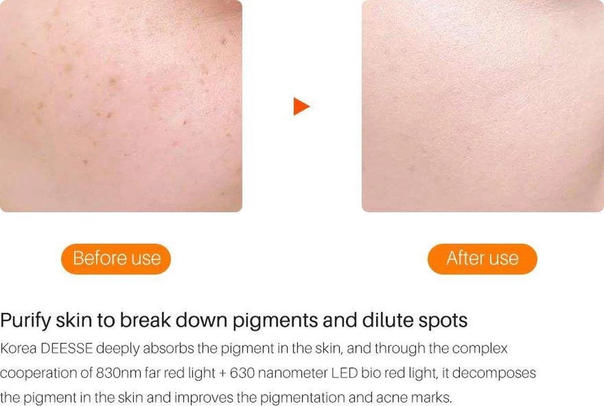 JTEX® - Professioneel LED Masker - Gezichtsmasker - Face Mask - Lichttherapie - 7 Soorten Behandelingen - Anti Rimpel - Anti Acne Huidverzorging - Skin Cleaner - Masker - Anti Aging Mask - Gezichtsbehandeling - New Generation - LED Masker 7 JTEX® - Professioneel LED Masker - Gezichtsmasker - Face Mask - Lichttherapie - 7 Soorten Behandelingen - Anti Rimpel - Anti Acne Huidverzorging - Skin Cleaner - Masker - Anti Aging Mask - Gezichtsbehandeling - New Generation - LED Masker - Afbeelding 5