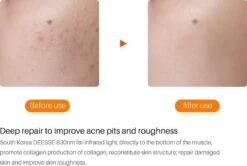 JTEX® - Professioneel LED Masker - Gezichtsmasker - Face Mask - Lichttherapie - 7 Soorten Behandelingen - Anti Rimpel - Anti Acne Huidverzorging - Skin Cleaner - Masker - Anti Aging Mask - Gezichtsbehandeling - New Generation - LED Masker 19 JTEX® - Professioneel LED Masker - Gezichtsmasker - Face Mask - Lichttherapie - 7 Soorten Behandelingen - Anti Rimpel - Anti Acne Huidverzorging - Skin Cleaner - Masker - Anti Aging Mask - Gezichtsbehandeling - New Generation - LED Masker -Lichaamsverzorging Winkel 1200x808 3