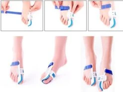 Hallux Valgus Statische Nachtspalk - Rechts + Links - Foot Pijnbestrijding - Teen Separator - Duim Corrector - Blauw / Wit -Lichaamsverzorging Winkel 1200x899 6