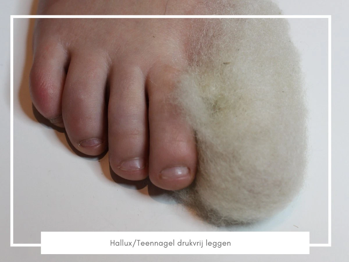 Merkloos WandelWol 10 Gram - De Oplossing Bij Blaren En Voet Ongemak - Antidruk & Antiblaar 6 Merkloos WandelWol 10 Gram - De Oplossing Bij Blaren En Voet Ongemak - Antidruk & Antiblaar - Afbeelding 4