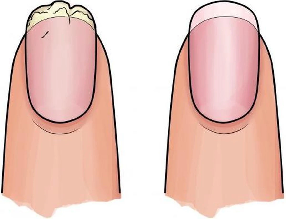 Herome 3 In 1 Manicure Nagelverzorging Set Blauw – Nagelset Voor Beschadigde Nagels - Nagelverharder, Nagellakremover En Nagelriemcreme - Set Van 3 5 Herome 3 In 1 Manicure Nagelverzorging Set Blauw – Nagelset Voor Beschadigde Nagels - Nagelverharder, Nagellakremover En Nagelriemcreme - Set Van 3 - Afbeelding 3