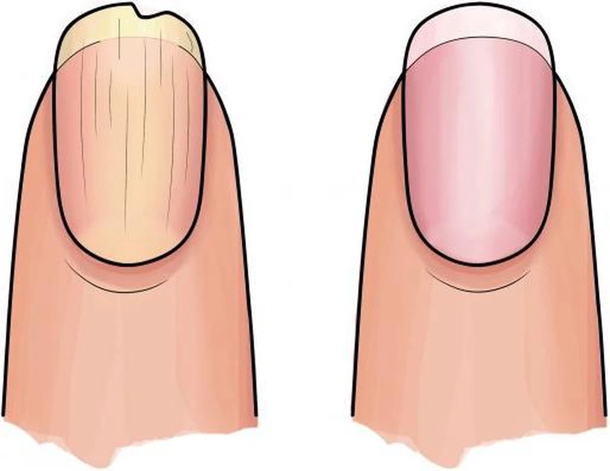 Herome 3 In 1 Manicure Nagelverzorging Set (Nail Essentials Geel) – Nagelset Voor Droge En Geribbelde Nagels – Base Coat, Vijl En Voedende Nagelolie – Voor Egale En Flexibele Nagels 5 Herome 3 In 1 Manicure Nagelverzorging Set (Nail Essentials Geel) – Nagelset Voor Droge En Geribbelde Nagels – Base Coat, Vijl En Voedende Nagelolie – Voor Egale En Flexibele Nagels - Afbeelding 3