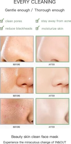 Merkloos Green Mask Stick - Huidverzorging - Gezichtsmasker - Kleimasker - Mee Eters & Acne Verwijderen - Acne Verzorging - Vette Huid - Mee-eter Verwijderaar - Poriën Reiniger -Blackhead - Verzachtend -Verkoelend - Dermatologisch Getest 15 Merkloos Green Mask Stick - Huidverzorging - Gezichtsmasker - Kleimasker - Mee Eters & Acne Verwijderen - Acne Verzorging - Vette Huid - Mee-eter Verwijderaar - Poriën Reiniger -Blackhead - Verzachtend -Verkoelend - Dermatologisch Getest -Lichaamsverzorging Winkel 592x1200 1