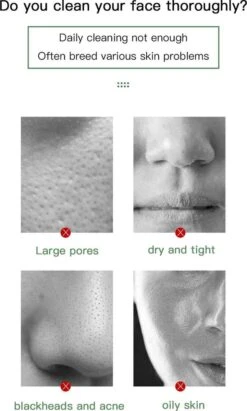 Merkloos Green Mask Stick - Huidverzorging - Gezichtsmasker - Kleimasker - Mee Eters & Acne Verwijderen - Acne Verzorging - Vette Huid - Mee-eter Verwijderaar - Poriën Reiniger -Blackhead - Verzachtend -Verkoelend - Dermatologisch Getest 16 Merkloos Green Mask Stick - Huidverzorging - Gezichtsmasker - Kleimasker - Mee Eters & Acne Verwijderen - Acne Verzorging - Vette Huid - Mee-eter Verwijderaar - Poriën Reiniger -Blackhead - Verzachtend -Verkoelend - Dermatologisch Getest -Lichaamsverzorging Winkel 721x1200 3