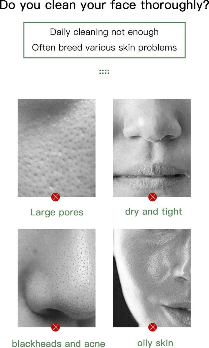 Merkloos Green Mask Stick - Huidverzorging - Gezichtsmasker - Kleimasker - Mee Eters & Acne Verwijderen - Acne Verzorging - Vette Huid - Mee-eter Verwijderaar - Poriën Reiniger -Blackhead - Verzachtend -Verkoelend - Dermatologisch Getest 6 Merkloos Green Mask Stick - Huidverzorging - Gezichtsmasker - Kleimasker - Mee Eters & Acne Verwijderen - Acne Verzorging - Vette Huid - Mee-eter Verwijderaar - Poriën Reiniger -Blackhead - Verzachtend -Verkoelend - Dermatologisch Getest - Afbeelding 4