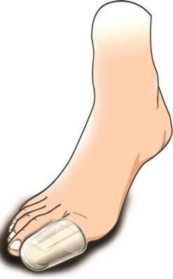 Gel Teenbeschermer (soft Gel) M/L -Lichaamsverzorging Winkel 744x1200