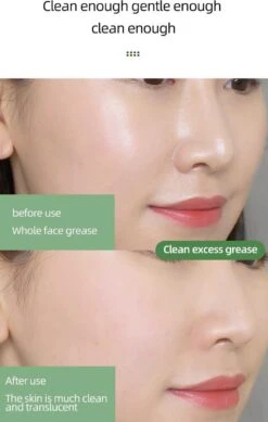 MENGSIQI - Green Mask Stick - Huidverzorging - Gezichtsmasker - Kleimasker - Mee Eters & Acne Verwijderen - Acne Verzorging - Vette Huid - Mee-eter Verwijderaar - Poriën Reiniger -Blackhead - Unisex - Verzachtend -Verkoelend - Dermatologisch Getest -Lichaamsverzorging Winkel 761x1200