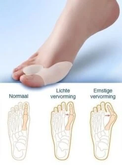 MYCARE+ Teencorrector - Wasbare Teencorrector - Gel-laag - 1 Paar - Pijn Verlichtend 11 MYCARE+ Teencorrector - Wasbare Teencorrector - Gel-laag - 1 Paar - Pijn Verlichtend -Lichaamsverzorging Winkel 890x1200