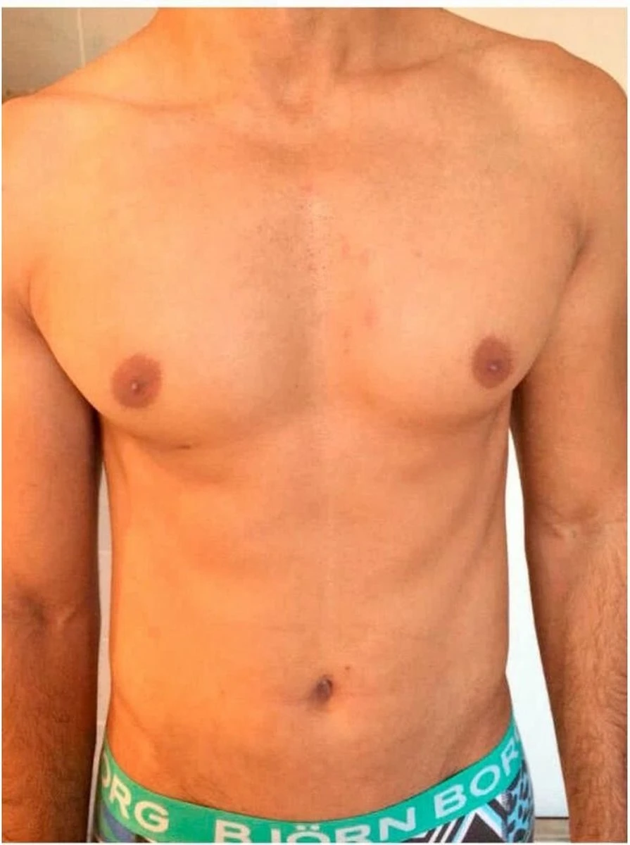 Intimate - Hair Removal Ontharingspoeder - 70 Gram 6 Intimate - Hair Removal Ontharingspoeder - 70 Gram - Afbeelding 4