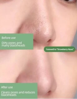 Sidas Mask PAQIMAN - Green Mask Stick - Gezichtsmasker - Mee Eters Verwijderen - Blackhead Remover - Verkoelend - Hydraterend - Kleimasker- Klei Masker - Verzachtend - Groene Thee - Huidverzorging - Maskers -Lichaamsverzorging Winkel 936x1200 2