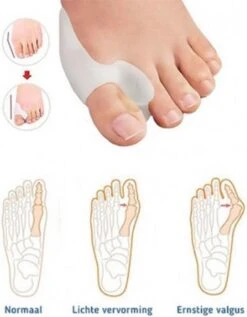 MYCARE+ Teencorrector - Wasbare Teencorrector - Gel-laag - 1 Paar - Pijn Verlichtend 12 MYCARE+ Teencorrector - Wasbare Teencorrector - Gel-laag - 1 Paar - Pijn Verlichtend -Lichaamsverzorging Winkel 936x1200